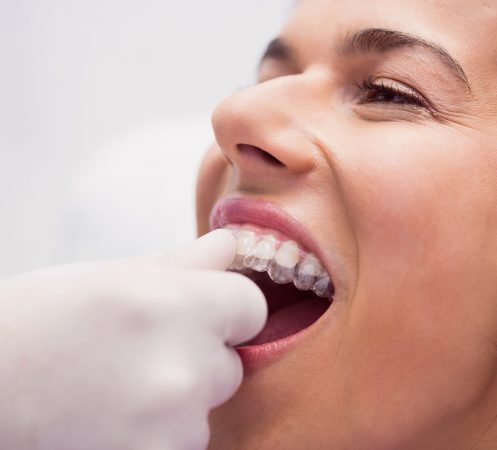 Dentist assisting female patient to wear braces in dental clinic