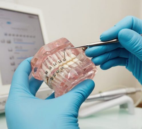 dentista-sosteniendo-modelo-plastico-dental-aparatos-ortopedicos_273609-13103